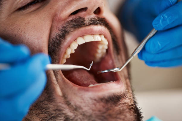 Best Emergency Root Canal Therapy in Silver Ridge, NJ